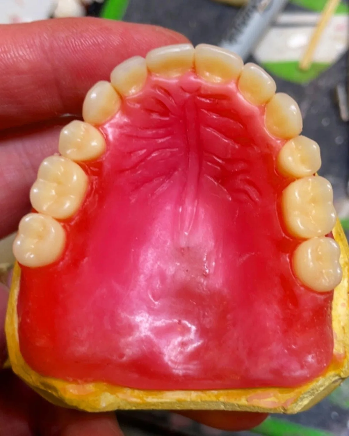 Upper denture